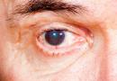 Первые признаки начальной катаракты